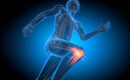 Lateral IT Band Knee Pain