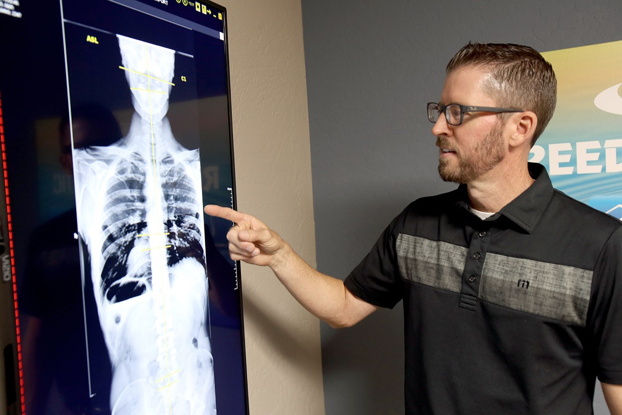 Digital X-Rays Dr. Reed
