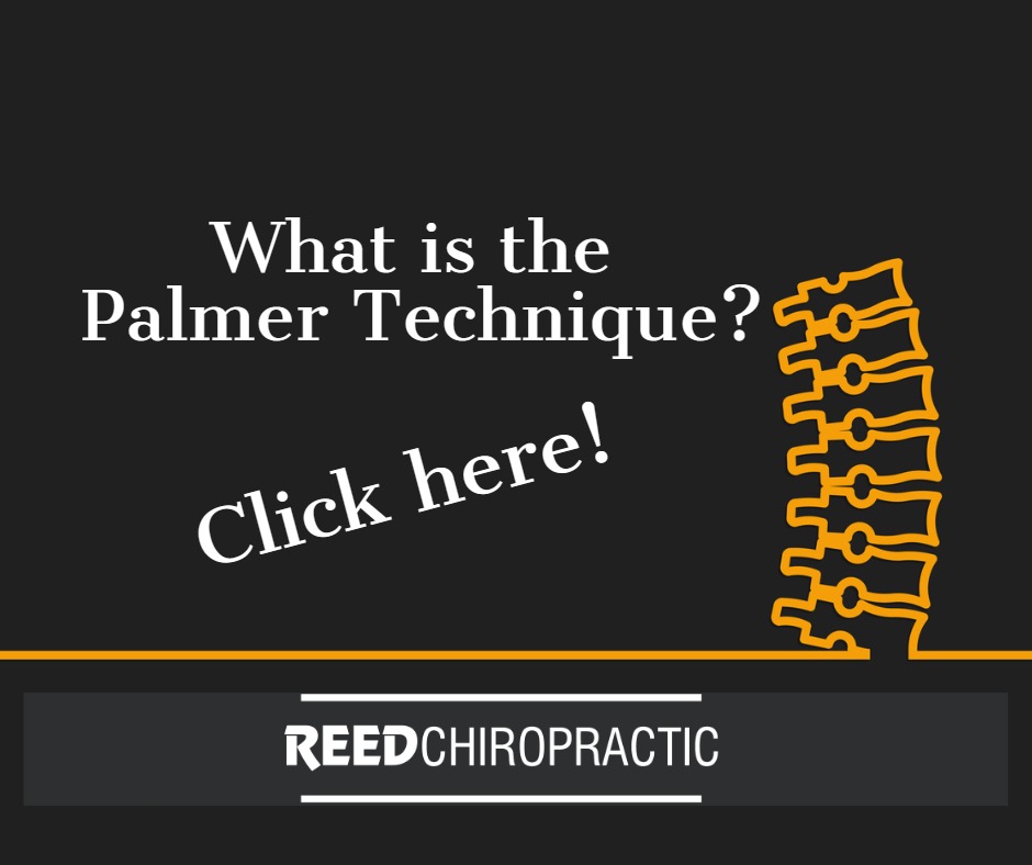 What is the Palmer Technique?
