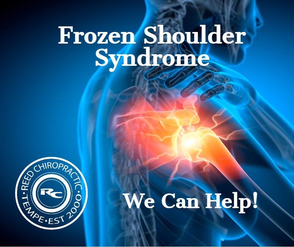 Frozen Shoulder Blog Picture