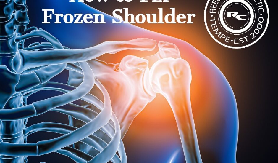 How to Fix Frozen Shoulder